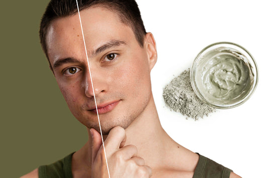 Green clay mask before and after on acne skin
